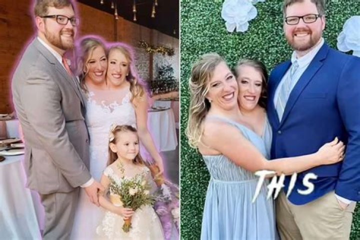 Abby & Brittany Hensel Today: A Journey of Inspiration and Resilience