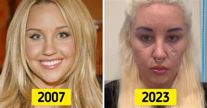 Amanda Bynes Looks Different: A Deep Dive into Her Transformation