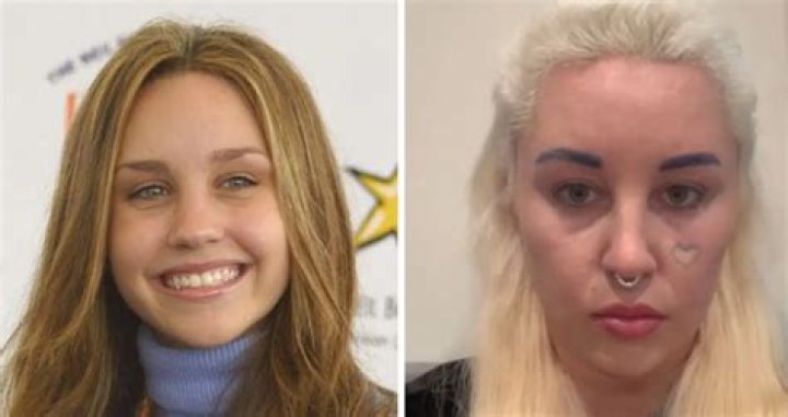 Amanda Bynes: What Is She Doing Now?