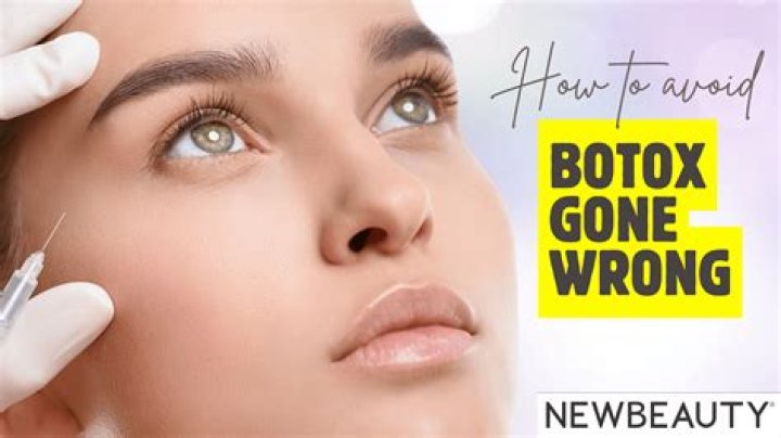 Botox Blunders: Cautionary Tales of Botox Gone Wrong
