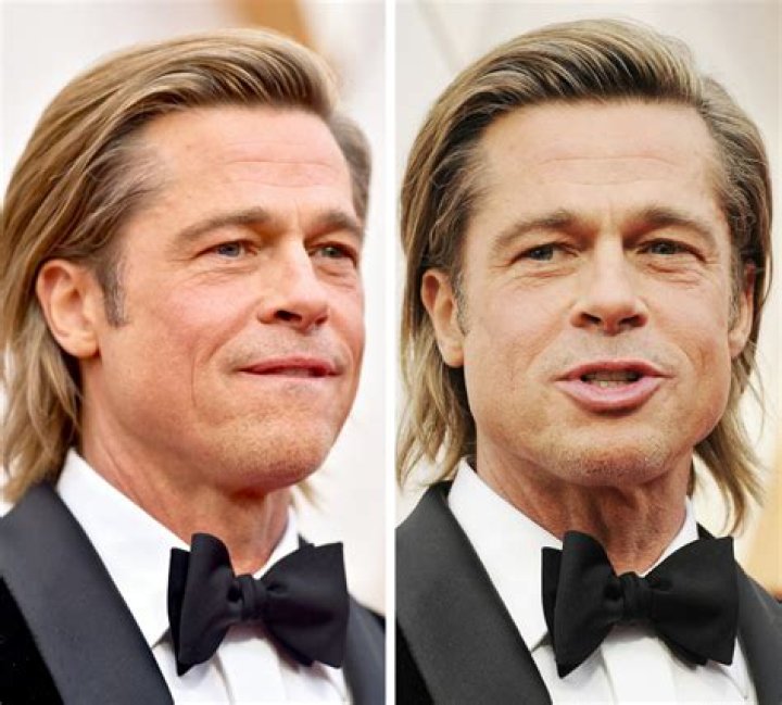 Brad Pitt and the Influence of Plastic Surgery: A Comprehensive Insight