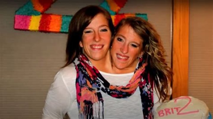 Do Abby and Brittany Hensel Have Two Hearts?