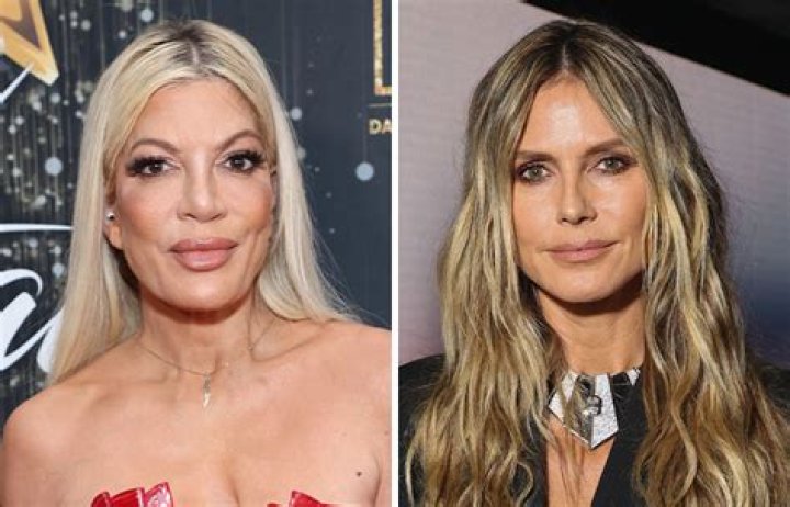 Heidi Klum Plastic Surgery: A Comprehensive Look at Her Transformation