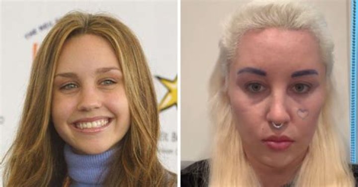 Images of Amanda Bynes Today: A Comprehensive Look at Her Journey and Current Life