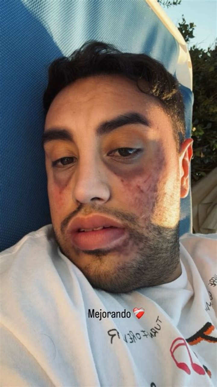 Jhanelle Castillo Net Worth: A Deep Dive into His Wealth and Success