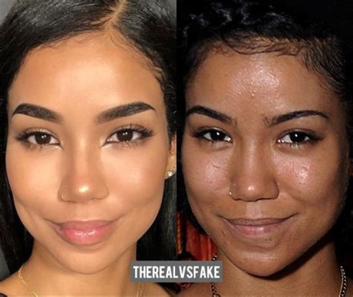 Jhené Aiko Before Surgery: A Deep Dive into Her Journey
