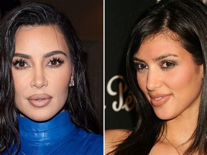 Kim Kardashian Before and After: A Journey Through Transformation