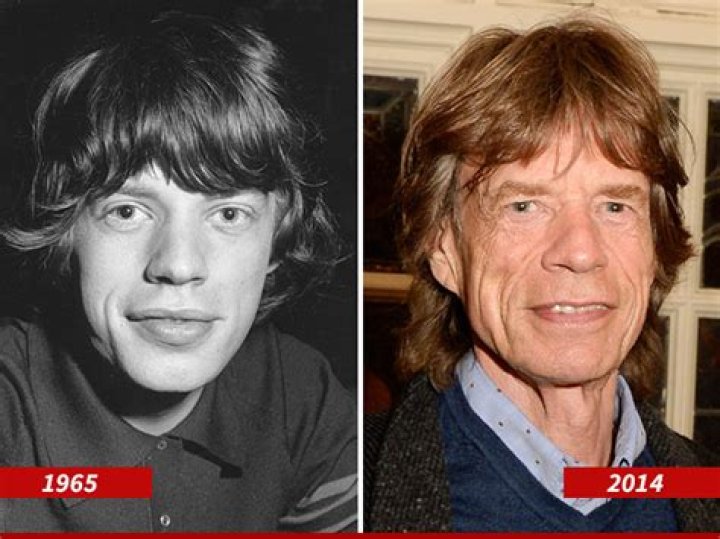 Mick Jagger Plastic Surgery: Truth Behind the Rock Legend's Transformation