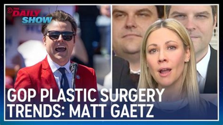 Uncovering the Truth: Matt Gaetz Navigates Plastic Surgery and Twitter Controversies